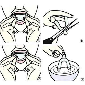 Anti-Snoring Mouth Guard Set Rieworkes