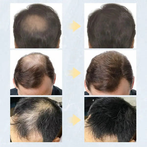 Keratin Hair Fibers Rieworkes