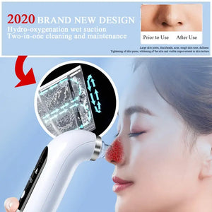 Blackhead Vacuum Suction Remover Rieworkes