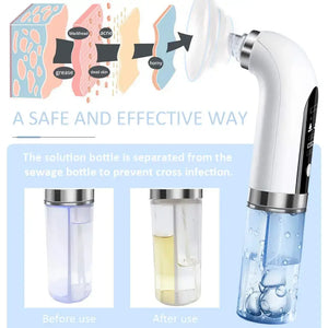 Blackhead Vacuum Suction Remover Rieworkes