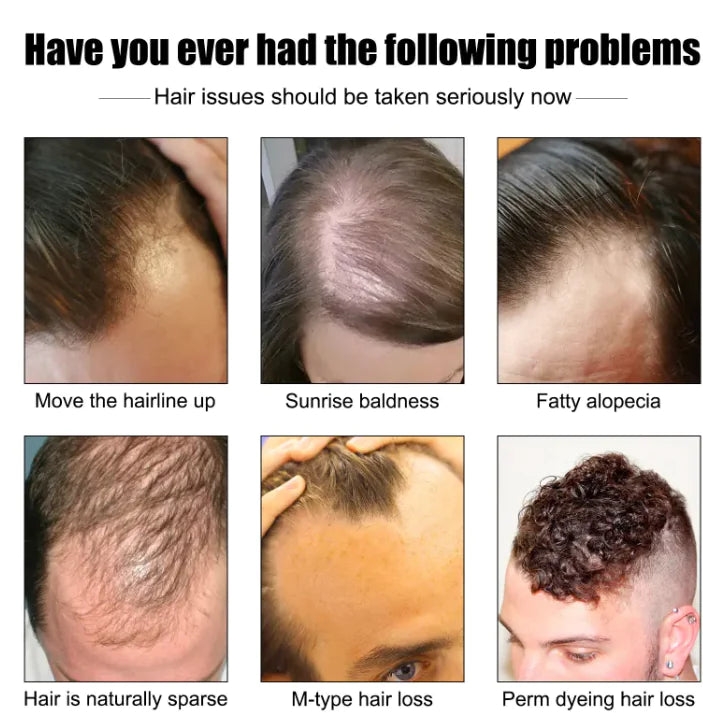 Men's Hair Growth Essence Rieworkes
