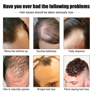 Men's Hair Growth Essence Rieworkes