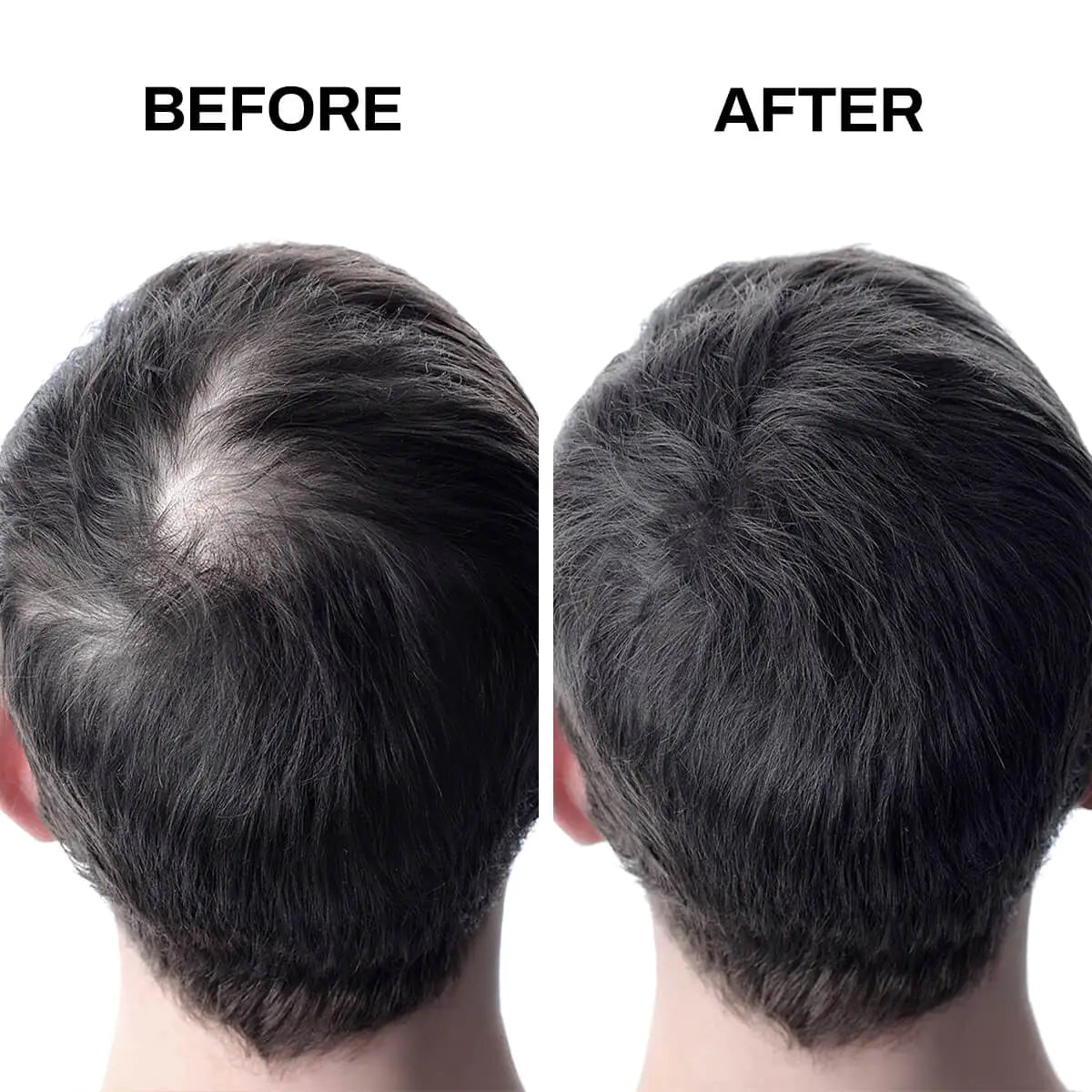 Hair Fibers Thinning Hair Rieworkes