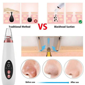 USB Rechargeable Blackhead Remover Vacuum Rieworkes