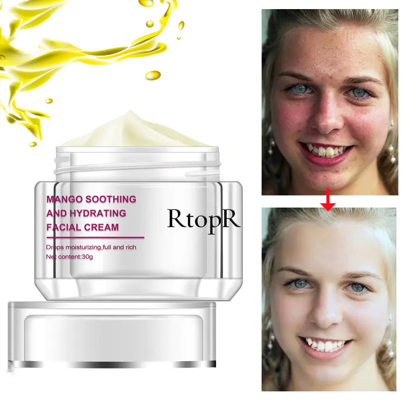 RtopR Moisturizing Cream - International Trade Product Mimarta