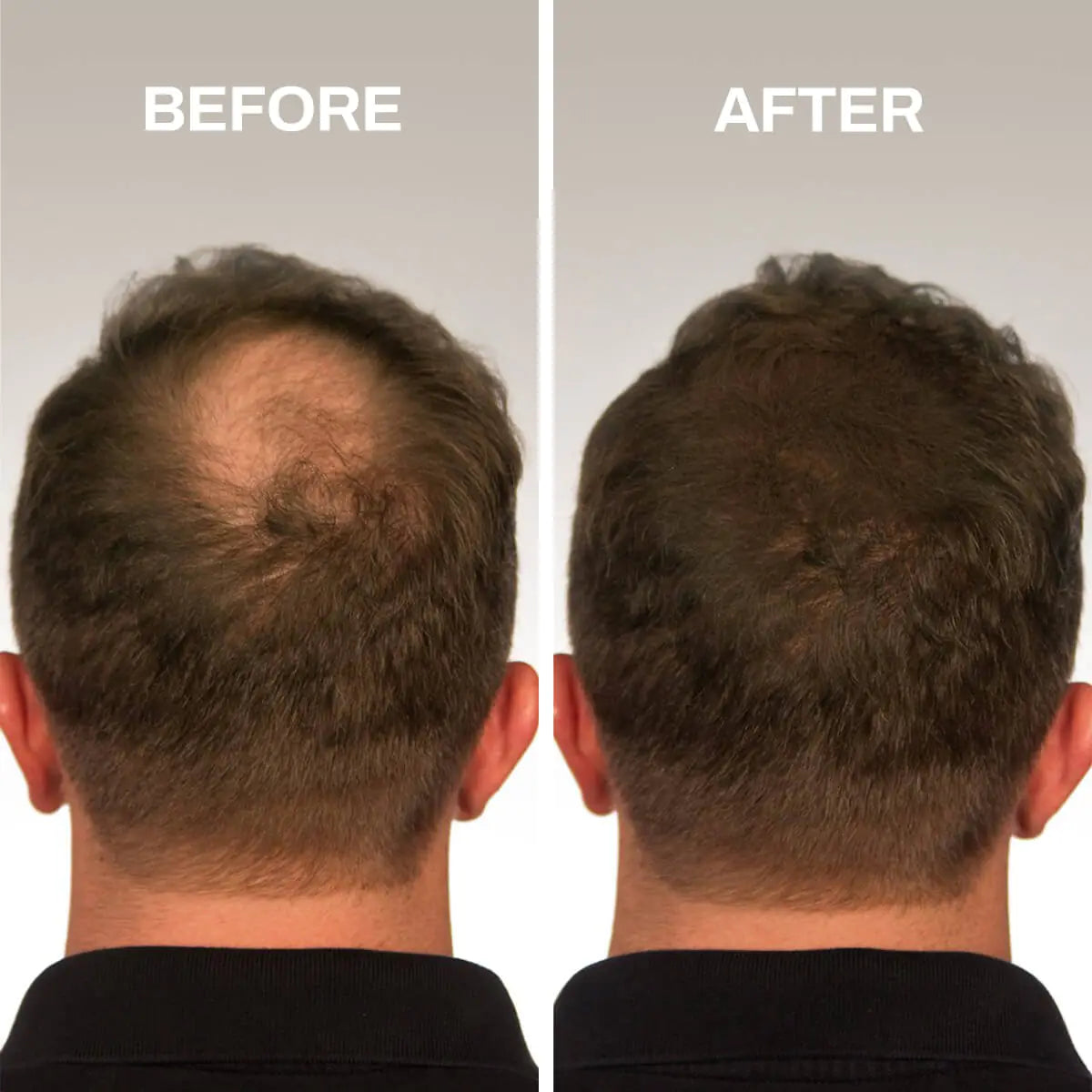 Hair Fibers Thinning Hair Rieworkes