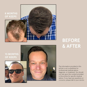 Keeps Hair Growth Shampoo and Conditioner Set - Treatment for Thinning Hair and Hair Regrowth - Men's Hair Products Infused with Biotin, Caffeine, & Saw Palmetto Shampoo & Conditioner Set Rieworkes