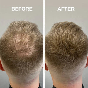 Hair Fibers Thinning Hair Rieworkes