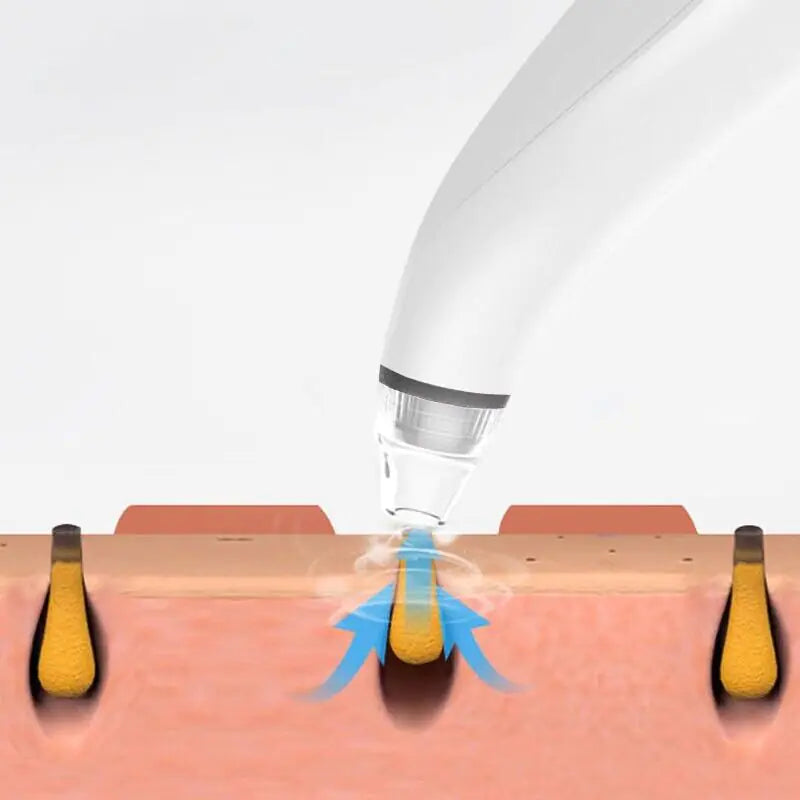 Electric Blackhead Remover Cleaner Face Diamond Pore Vacuum Suction White Heads Rieworkes