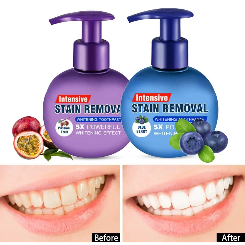 Toothpaste Whitening Teeth Stain Removal Rieworkes