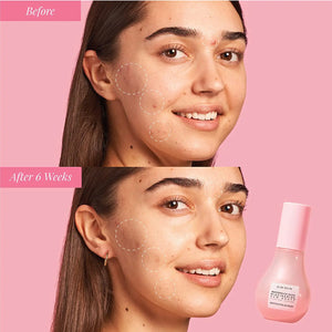 Glow Recipe Watermelon Glow Niacinamide Dew Drops Face Serum - Hydrating Hyaluronic Acid Skincare Serum, Makeup Primer & Liquid Highlighter for Dewy, Glowing Skin - Brightening Face Serums (40ml) 1.35 Fl Oz (Pack of 1) Gray Rieworkes