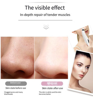 Electric Blackhead Remover Cleaner Face Diamond Pore Vacuum Suction White Heads Rieworkes