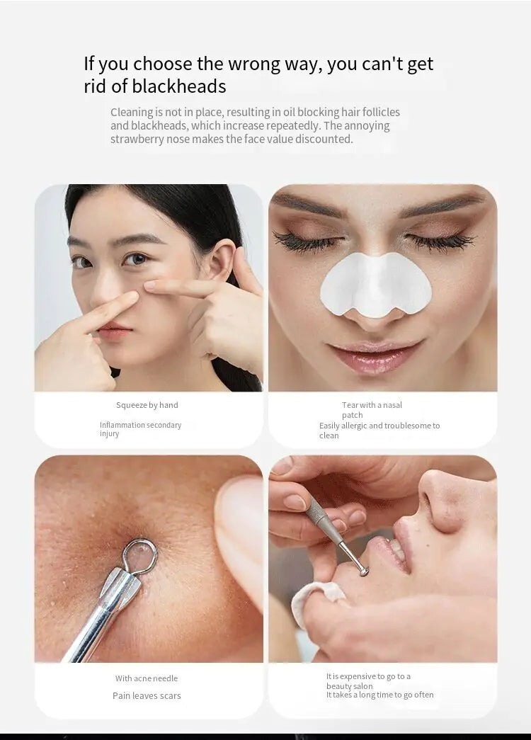 Electric Blackhead Remover Cleaner Face Diamond Pore Vacuum Suction White Heads Rieworkes