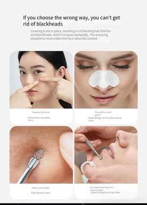 Electric Blackhead Remover Cleaner Face Diamond Pore Vacuum Suction White Heads Rieworkes