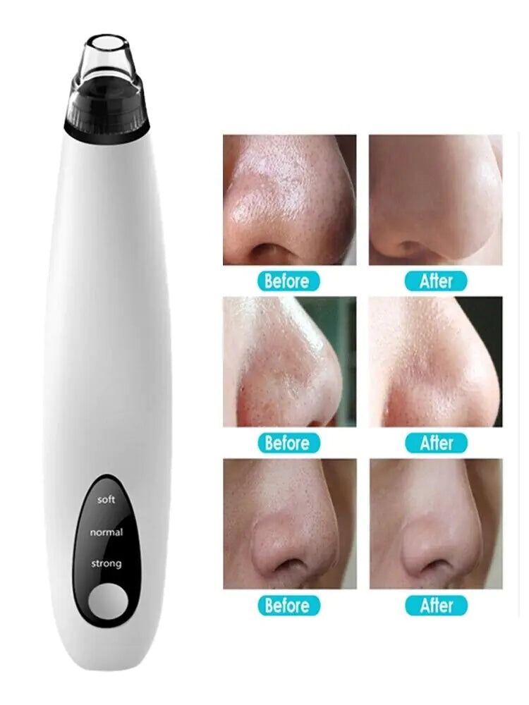 Electric Blackhead Remover Cleaner Face Diamond Pore Vacuum Suction White Heads Rieworkes