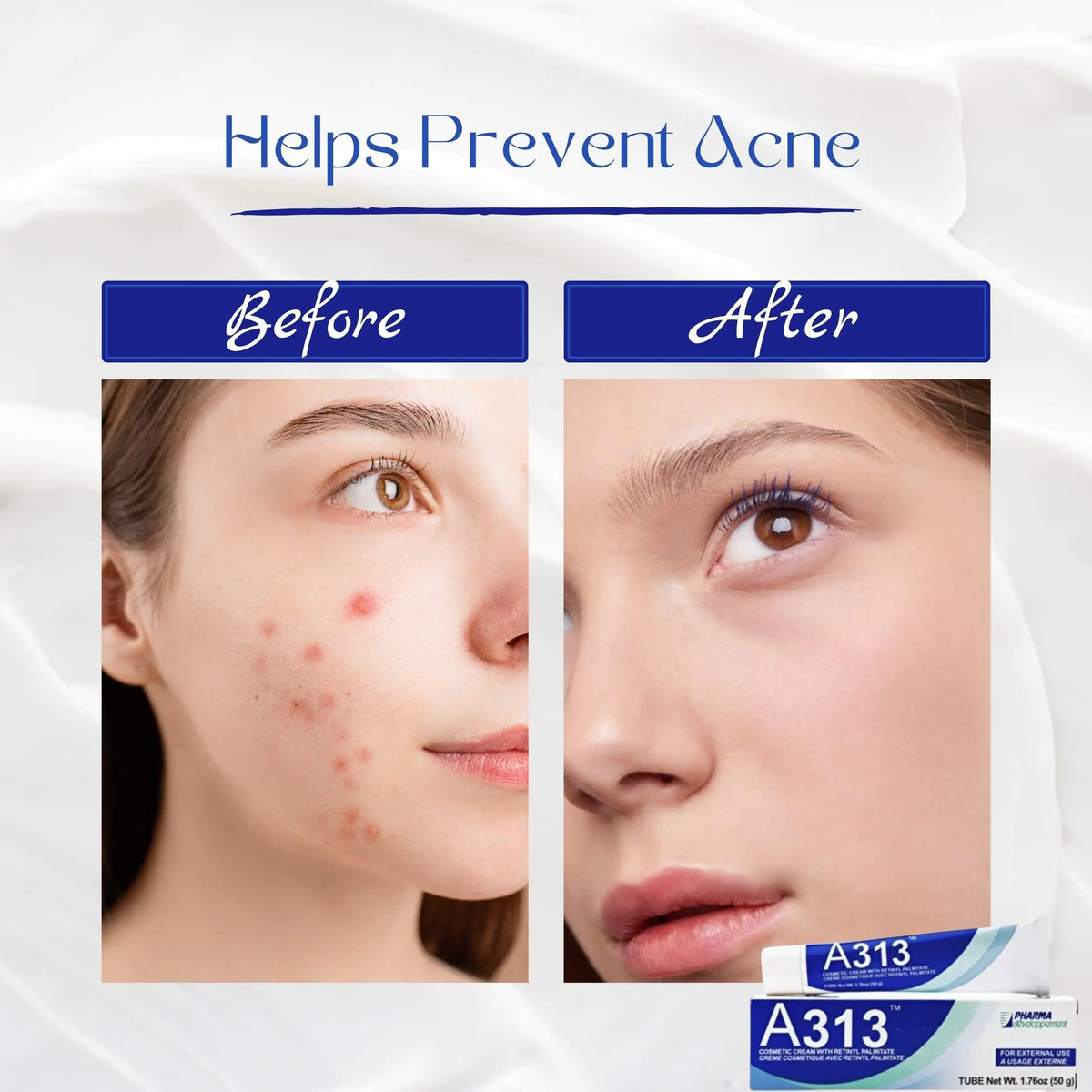 A313 Retinol Pommade Anti Aging Night Cream , The pore cleansing skin cream a313 Rieworkes