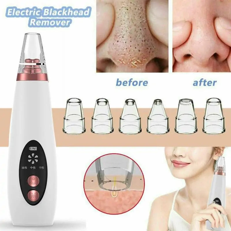 USB Rechargeable Blackhead Remover Vacuum Rieworkes