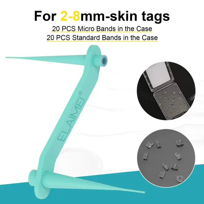 Skin Tag Remover Kit Rieworkes