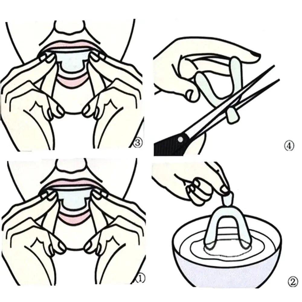 Anti-Snoring Mouth Guard Set Rieworkes