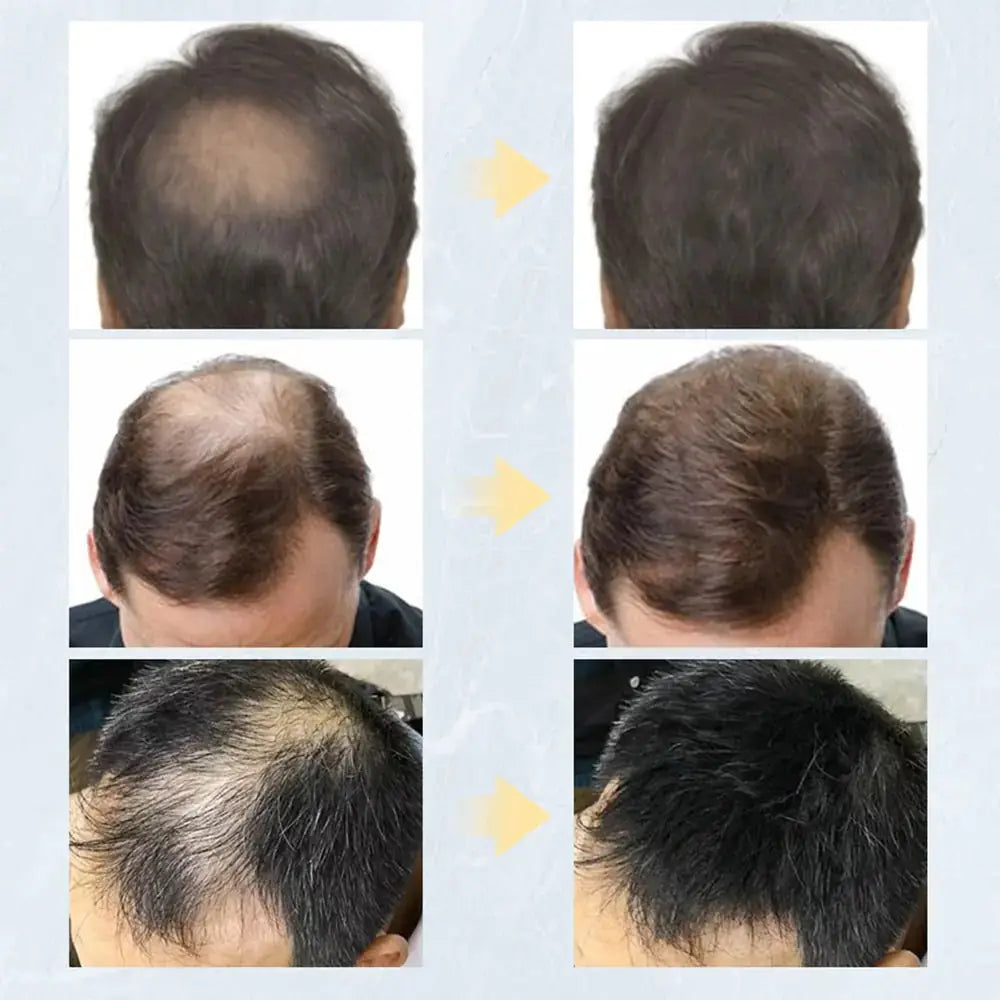 Keratin Hair Fibers Rieworkes