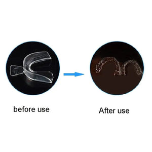 Anti-Snoring Mouth Guard Set Rieworkes