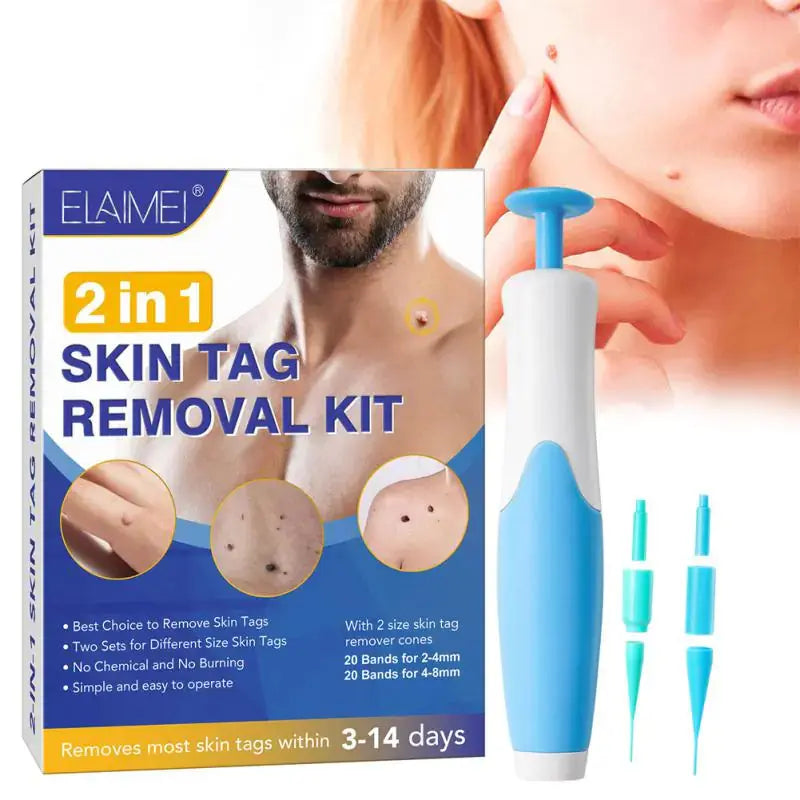 Skin Tag Remover Kit Rieworkes