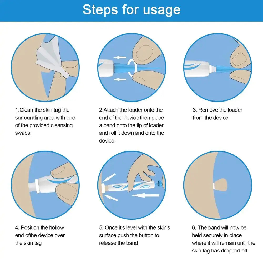 Painless Wart Removal Kit Rieworkes