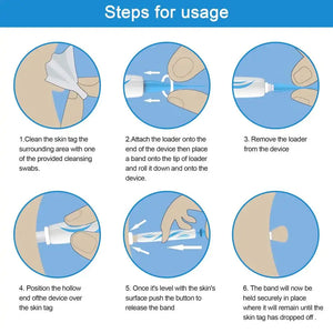 Painless Wart Removal Kit Rieworkes