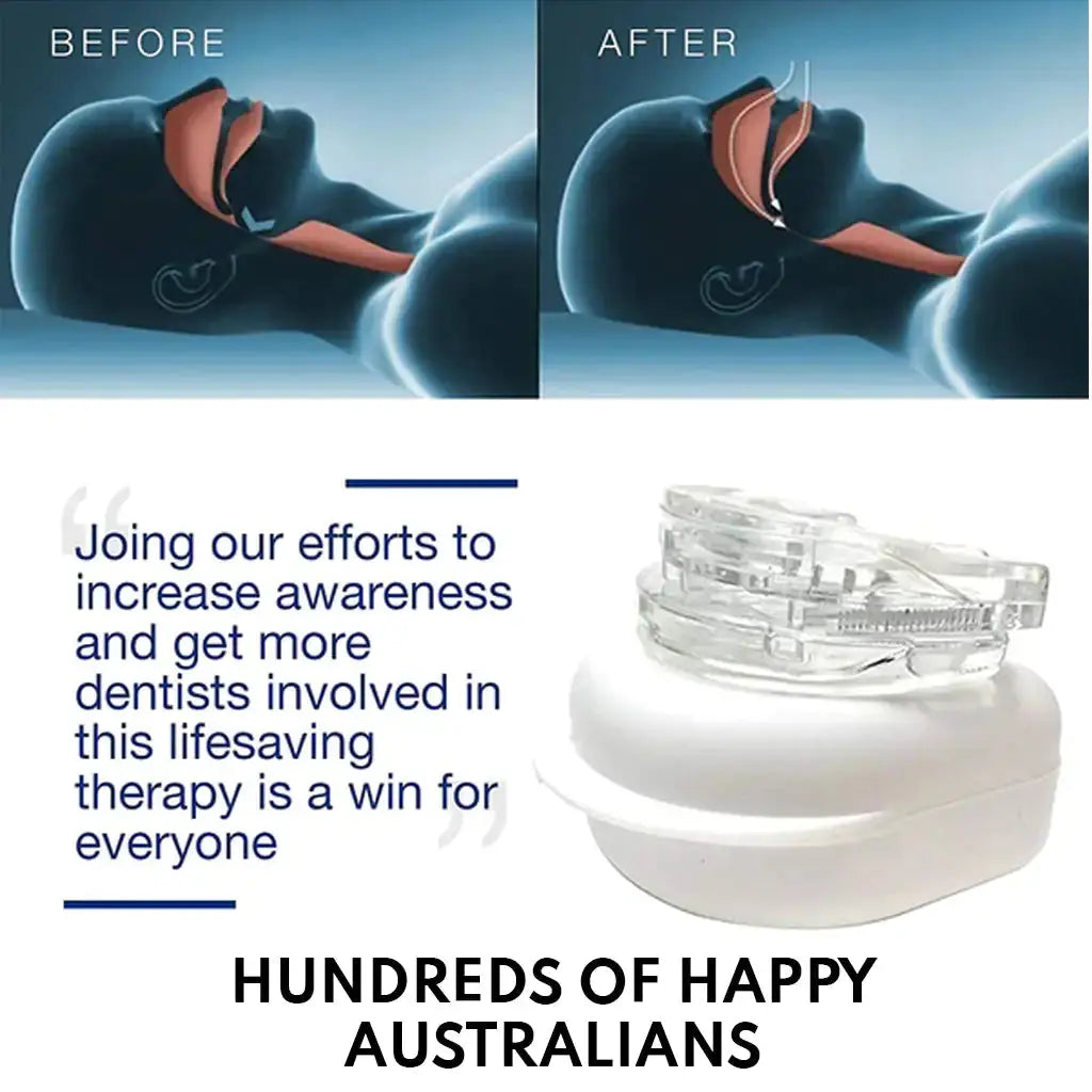 Anti-Snoring Mouthpiece Rieworkes